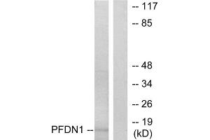 Western blot analysis of extracts from RAW264. (PFDN1 抗体  (N-Term))