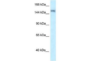 WB Suggested Anti-LRRK1 Antibody Titration: 1. (LRRK1 抗体  (N-Term))