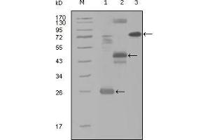 Western Blot showing MAP4K4 antibody used against truncated Trx-MAP4K4 recombinant protein (1), MBP-MAP4K4 (aa300-400) recombinant protein (2) and MAP4K4 (aa194-436)-hIgGFc transfected CH0-K1 cell lysate (3). (MAP4K4 抗体  (AA 400-500))