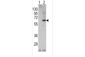 Western blot analysis of PRKAA2 using rabbit polyclonal PRKAA2 Antibody using 293 cell lysates (2 ug/lane) either nontransfected (Lane 1) or transiently transfected with the PRKAA2 gene (Lane 2). (PRKAA2 抗体  (C-Term))