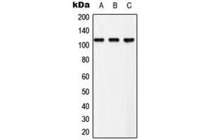 Western blot analysis of EPHB3 (pY608) expression in Hela (A), NIH3T3 (B), PC12 (C) whole cell lysates. (EPH Receptor B3 抗体  (pTyr608))