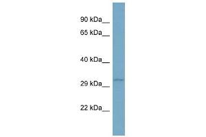 TNFSF13B antibody used at 1 ug/ml to detect target protein. (BAFF 抗体)