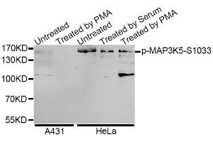 Western blot analysis of extracts of A-431 and HeLa cells, using Phospho-MAP3K5-S1033 antibody (ABIN5995640) at 1/1000 dilution. (ASK1 抗体  (pSer1033))