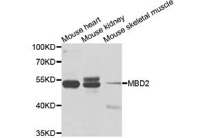 Western blot analysis of extracts of various cell lines, using MBD2 antibody (ABIN5971247) at 1/1000 dilution. (MBD2 抗体)