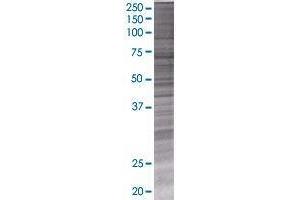 RMI1 transfected lysate. (RMI1 293T Cell Transient Overexpression Lysate(Denatured))