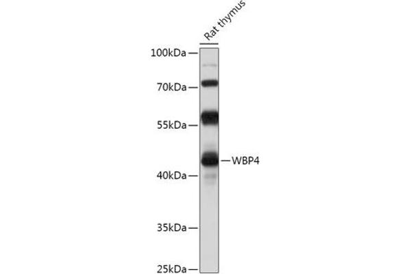 WBP4 抗体  (AA 1-376)