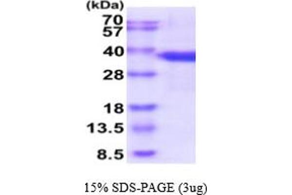 SRSF1 Protein (AA 1-248) (His tag)