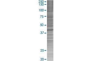 GLUL transfected lysate. (GLUL 293T Cell Transient Overexpression Lysate(Denatured))