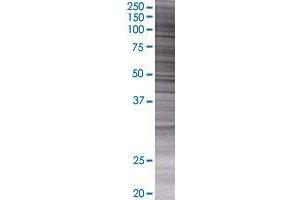 EXO1 transfected lysate. (EXO1 293T Cell Transient Overexpression Lysate(Denatured))