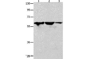 Western blot analysis of Human seminoma tissue, HT-29 and A549 cell, using DNAJC7 Polyclonal Antibody at dilution of 1:400 (DNAJC7 抗体)