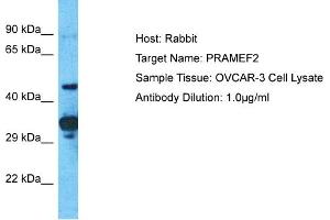 Host: Rabbit Target Name: PRAMEF2 Sample Tissue: Human OVCAR-3 Whole Cell Antibody Dilution: 1ug/ml (PRAMEF2 抗体  (C-Term))