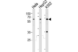 Western blot analysis of lysates from Hela, HepG2, K562 cell line (from left to right), using RIOK3 Antibody (Center) (ABIN6243990 and ABIN6577652). (RIOK3 抗体  (AA 146-179))