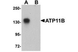 Western blot analysis of ATP11B in K562 cell tissue lysate with ATP11B antibody at 1 μg/ml in (A) the absence and (B) the presence of blocking peptide. (ATP11B 抗体  (N-Term))