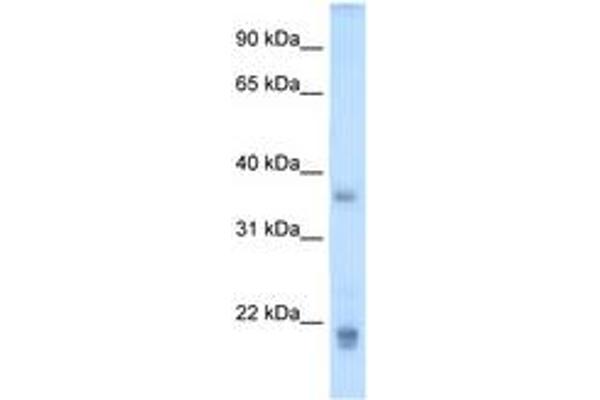 Growth Hormone 2 抗体  (C-Term)