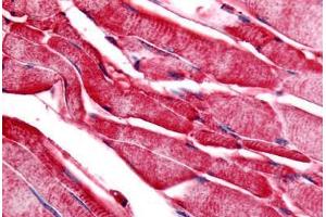 Human Skeletal Muscle (formalin-fixed, paraffin-embedded) stained with PYGM antibody ABIN213350 at 20 ug/ml followed by biotinylated goat anti-rabbit IgG secondary antibody ABIN481713, alkaline phosphatase-streptavidin and chromogen. (PYGM 抗体  (C-Term))