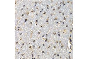 Immunohistochemistry of paraffin-embedded mouse brain using DNASE1 antibody at dilution of 1:200 (400x lens). (DNASE1 抗体)