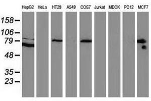 Image no. 2 for anti-Catenin (Cadherin-Associated Protein), beta 1, 88kDa (CTNNB1) antibody (ABIN1496895) (CTNNB1 抗体)