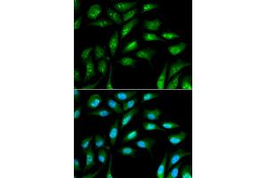 Immunofluorescence analysis of MCF-7 cells using B2M antibody (ABIN5970743). (beta-2 Microglobulin 抗体)