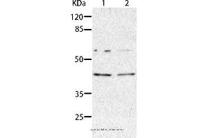 Western blot analysis of HepG2 and A549 cell, using AIMP2 Polyclonal Antibody at dilution of 1:350 (AIMP2 抗体)