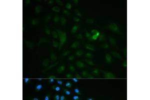Immunofluorescence analysis of MCF-7 cells using CD79B Polyclonal Antibody (CD79b 抗体)