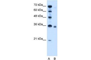 WB Suggested Anti-SGPP2 Antibody Titration:  2. (SGPP2 抗体  (C-Term))