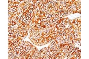 Immunohistochemistry (Formalin-fixed Paraffin-embedded Sections) (IHC (fp)) image for anti-Keratin 18 (KRT18) antibody (ABIN3026955)