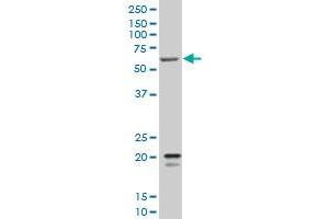 SMARCD3 monoclonal antibody (M02), clone 5F12 Western Blot analysis of SMARCD3 expression in K-562 . (SMARCD3 抗体  (AA 385-483))