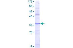 TACR1 Protein (AA 140-243) (GST tag)