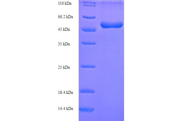 ABHD11 Protein (AA 1-307, full length) (His-SUMO Tag)