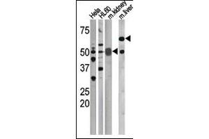 The anti-Phospho-CDC25A-S75 Pab (ABIN389531 and ABIN2839579) is used in Western blot to detect Phospho-CDC25A-S75 in, form left to right, Hela, HL60, mouse kidney, and mouse liver tissue lysates. (CDC25A 抗体  (pSer75))