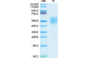 SDS-PAGE (SDS) image for FGFR2 beta (AA 152-378) protein (His tag) (ABIN7274646)