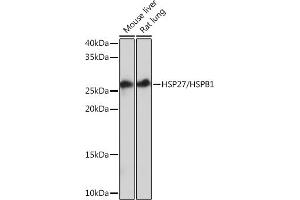 Western blot analysis of extracts of various cell lines, using HSP27/HSPB1Rabbit mAb (ABIN7267569) at 1:1000 dilution. (HSP27 抗体)