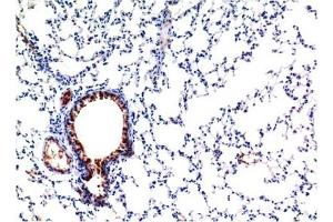 Immunohistochemical analysis of paraffin-embedded Mouse Lung Tissue using TGFβ1 Mouse mAb diluted at 1:200. (TGFB1 抗体)