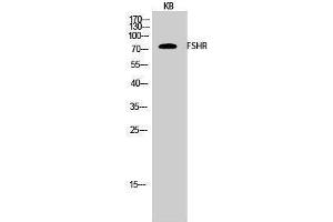 Western Blotting (WB) image for anti-Follicle Stimulating Hormone Receptor (FSHR) (Internal Region) antibody (ABIN3175168) (FSHR 抗体  (Internal Region))