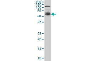 IRF5 monoclonal antibody (M04), clone 3C2 Western Blot analysis of IRF5 expression in A-431 . (IRF5 抗体  (AA 395-504))