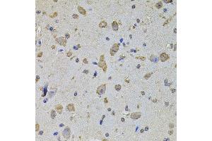 Immunohistochemistry of paraffin-embedded mouse brain using EIF4A2 antibody (ABIN5972034) at dilution of 1/100 (40x lens). (EIF4A2 抗体)