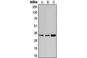 Western blot analysis of CD1e expression in HeLa (A), SP2/0 (B), H9C2 (C) whole cell lysates. (CD1e 抗体  (Center))