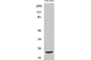 Western Blot analysis of various cells using Mob3B Polyclonal Antibody. (MOBKL2B 抗体  (AA 40-120))