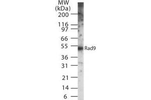 Image no. 1 for anti-RAD9 Homolog A (S. Pombe) (RAD9A) antibody (ABIN208030) (RAD9A 抗体)