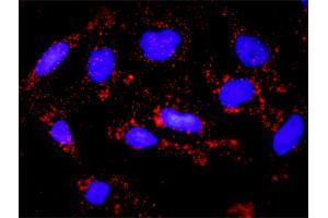 Proximity Ligation Analysis of protein-protein interactions between TP53 and BAX. (p53 抗体  (AA 1-393))