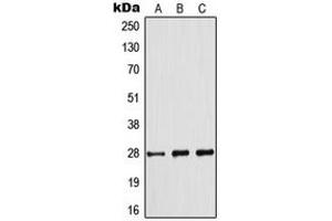 Western blot analysis of BCL2 (pS70) expression in Jurkat (A), THP1 (B), A2780 (C) whole cell lysates. (Bcl-2 抗体  (pSer70))
