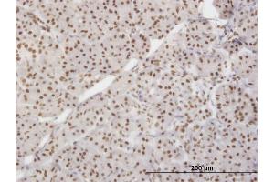 Immunostaining (ISt) image for anti-X-Ray Repair Complementing Defective Repair in Chinese Hamster Cells 5 (Double-Strand-Break Rejoining) (XRCC5) (AA 1-732) antibody (ABIN563391)