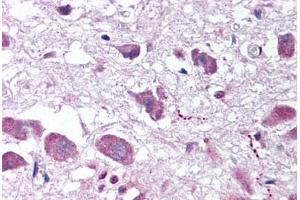 Human Brain, Hypothalamus (formalin-fixed, paraffin-embedded) stained with HCRT antibody ABIN291715 at 10 mg/ml followed by biotinylated secondary antibody, alkaline phosphatase-streptavidin and chromogen. (Orexin 抗体  (AA 2-14))