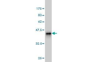 Western Blot detection against Immunogen (36. (DAZ1 抗体  (AA 21-120))