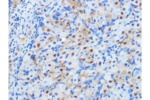 Immunohistochemistry of paraffin-embedded rat ovary using PP1 beta Rabbit mAb (ABIN1679819, ABIN3018859, ABIN3018860 and ABIN7101675) at dilution of 1:100 (40x lens). (PPP1CB 抗体)
