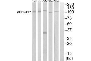 Western blot analysis of extracts from COLO205, HepG2, HuvEc and Jurkat cells, using ARHGEF1 antibody. (ARHGEF1 抗体  (Internal Region))