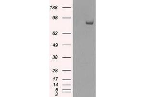 Western Blotting (WB) image for anti-SATB Homeobox 1 (SATB1) antibody (ABIN1500812) (SATB1 抗体)