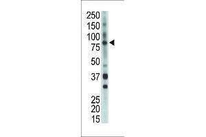 Antibody is used in Western blot to detect BMX in mouse heart tissue lysate. (BMX 抗体  (AA 212-242))