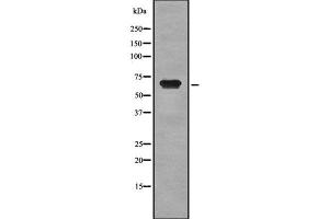 Western blot analysis of CD42b using MCF7 whole cell lysates (CD42b 抗体  (C-Term))