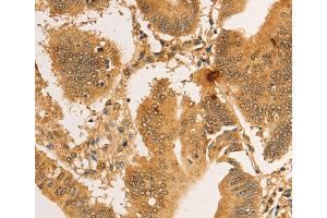 Immunohistochemistry (IHC) image for anti-Ribosomal Protein L26-Like 1 (RPL26L1) antibody (ABIN2422743) (RPL26L1 抗体)